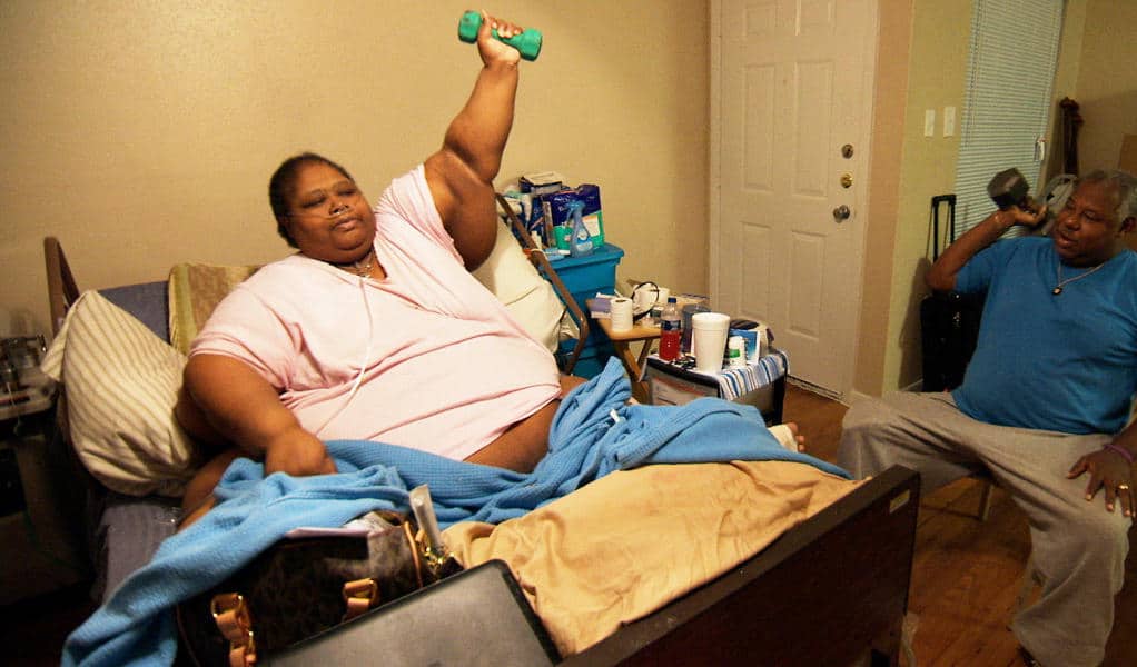 teretha 600 lb before chad remarkable progress lymphedema legs dr nowzaradan weighed chads