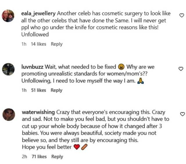 Heres What 90 Day Fiance Fans Have To Say About Loren Brovarniks Cosmetic Surgery 0028