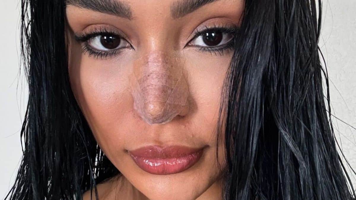 thais ramone snaps a post-surgery selfie